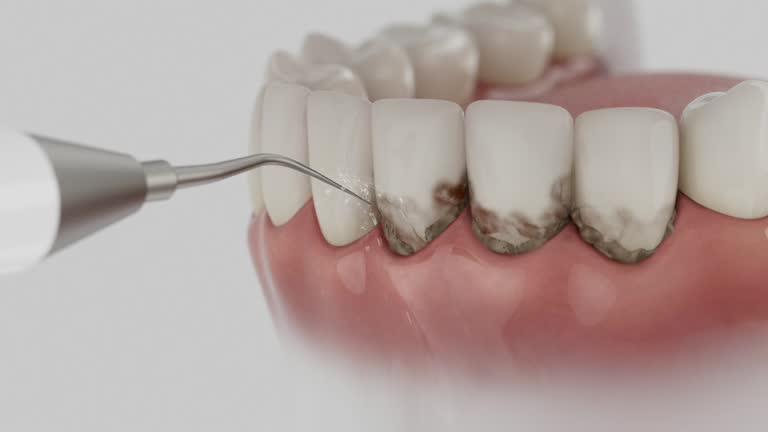 Reliable Root Canal Treatment contractor in Webster Parish County, LA by Dentist Open Now
